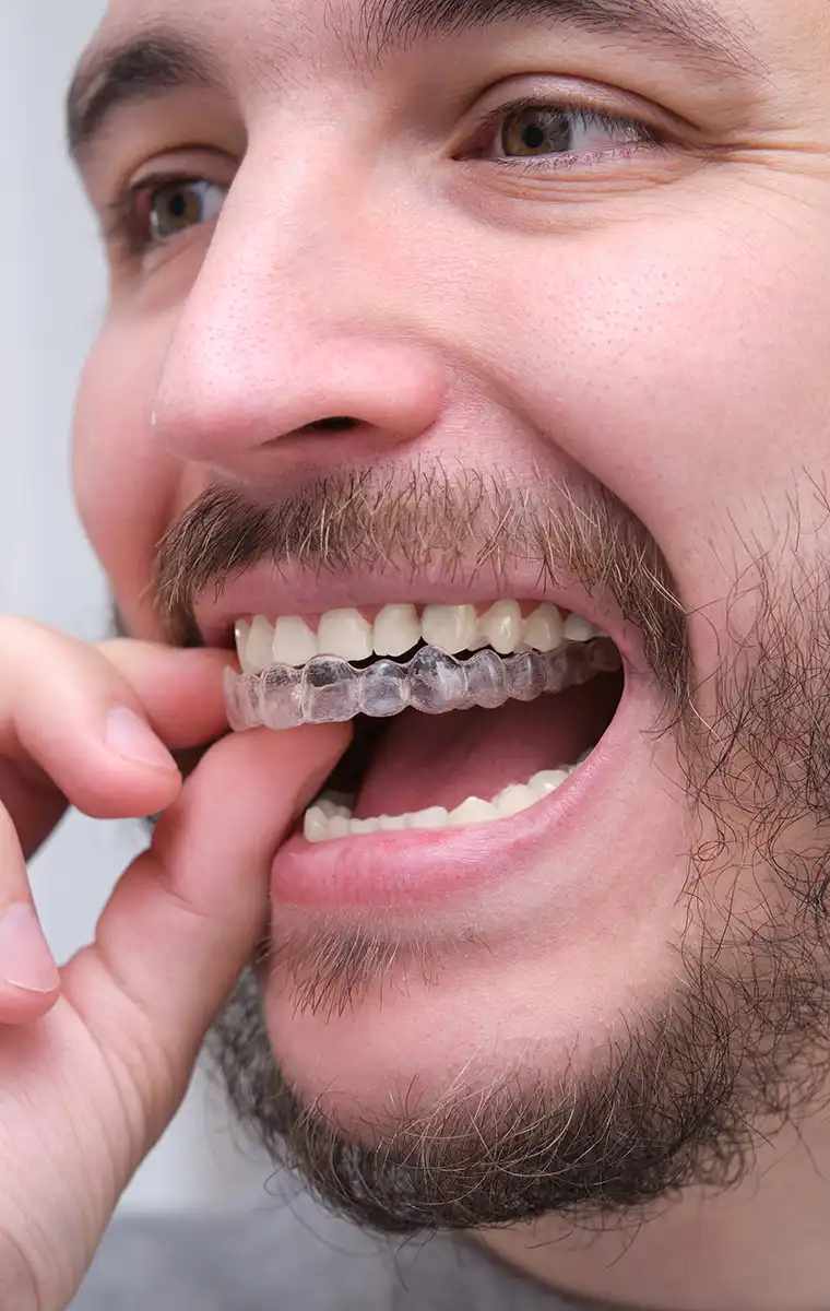 Dents alignées prestation ortodonthie lyon